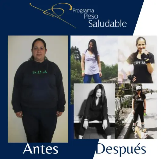 Testimonio de Alejandra Dacunha sobre la cirugia bariatrica