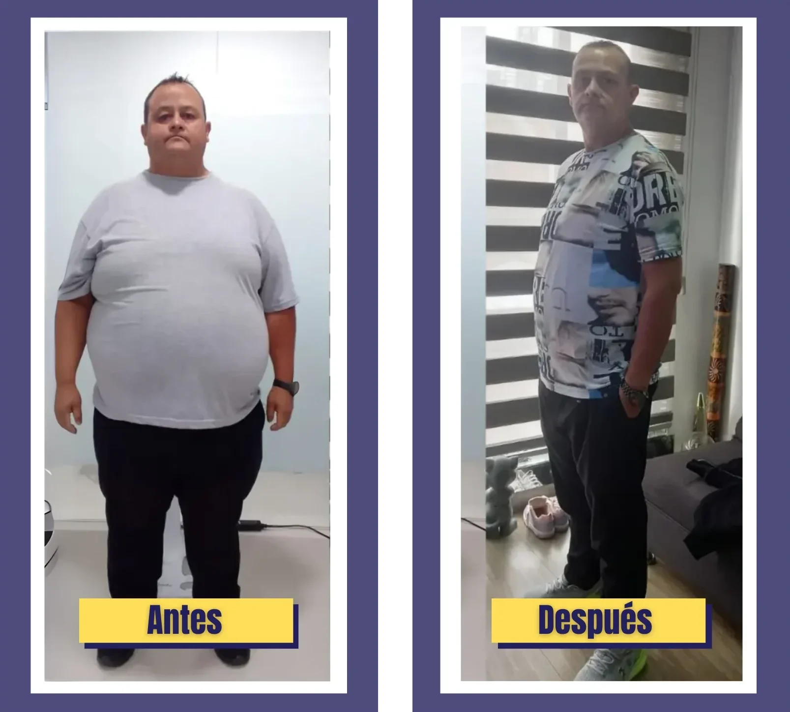 Antes y Despues de paciente gracias al programa peso saludable