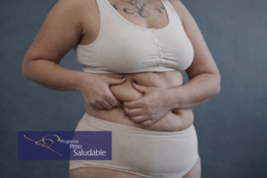 Cuáles son las operaciones para bajar de peso más utilizadas hoy