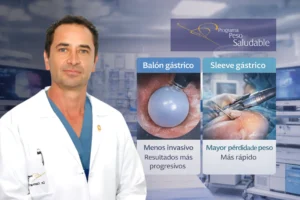 Operaciones para bajar de peso, ¿cómo saber si la cirugía bariátrica es adecuada para ti